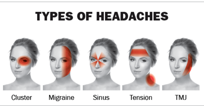 Maximizing Health and Wellness: The Key Elements of Headache Relief image