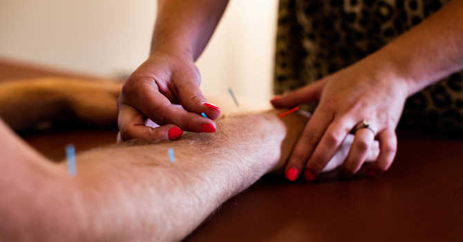 Chiropractic & Acupuncture Go Hand in Hand image