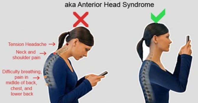 What The Heck Is Text Neck? How To Correct and Prevent This Common Condition
